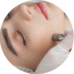 Icon aceup Dermabrasion